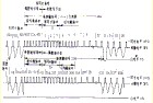 全電視信號