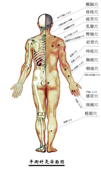 挑痔療法