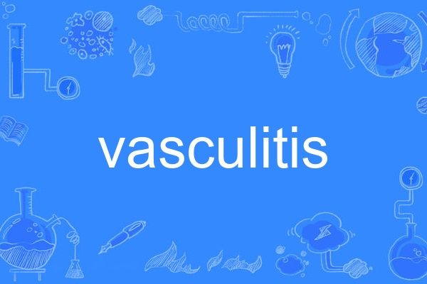 vasculitis