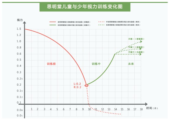 近視眼恢復