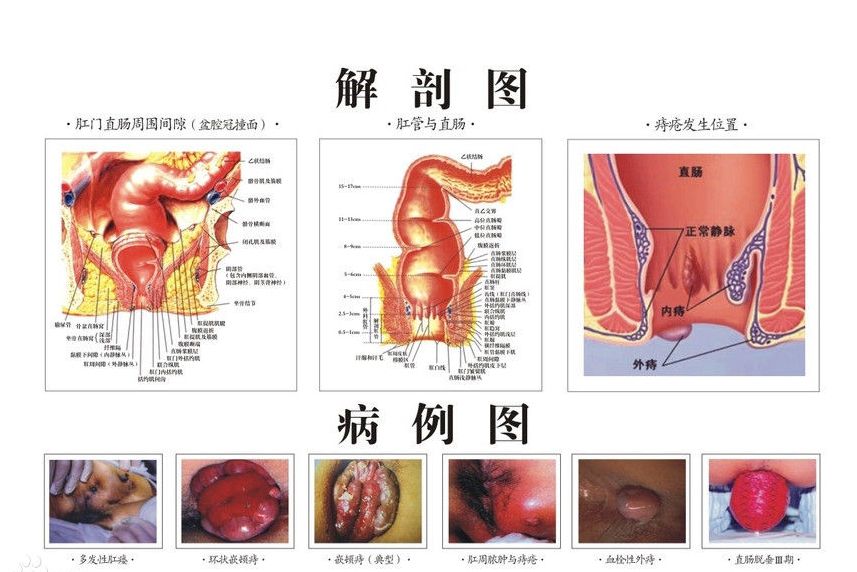 肛腸科