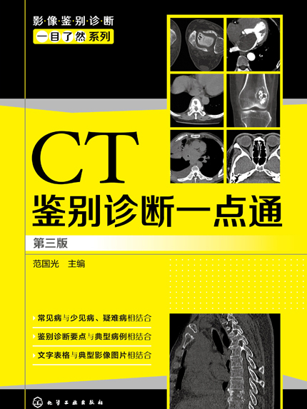 CT鑑別診斷一點通（第三版）