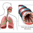 支氣管炎治療