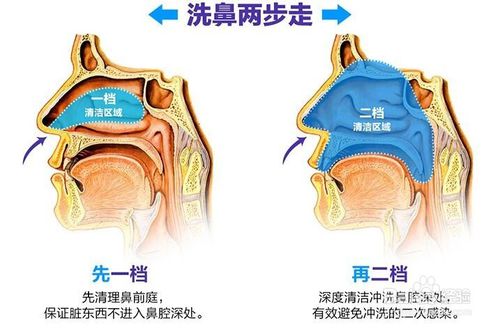 鹽水洗鼻