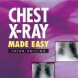 Chest X-Ray Made Easy