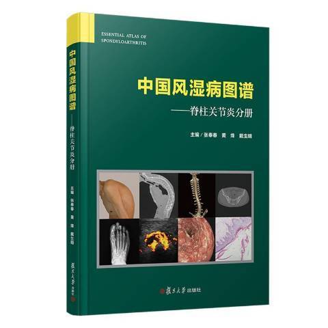 中國風濕病圖譜--脊柱關節炎分冊