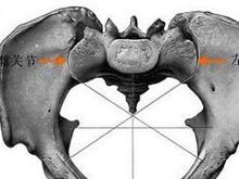 骶髂部劇烈疼痛