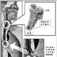 急性缺氧性腦病