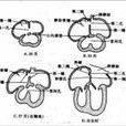 老年甲減性心臟病