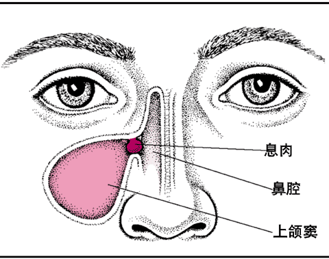 鼻額竇炎