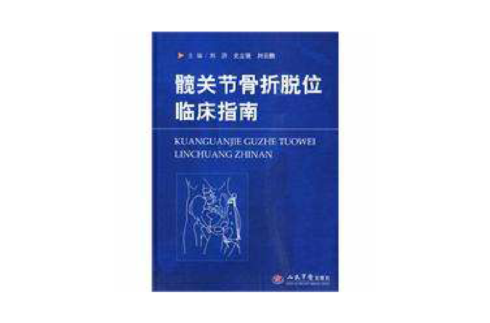 髖關節骨折脫位臨床指南