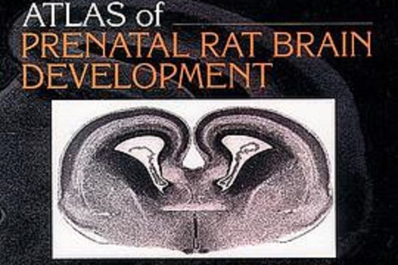 Atlas of Prenatal Rat Brain Development