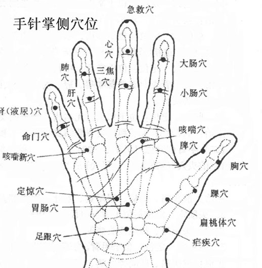 手針掌側穴位