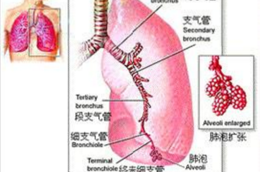 誘導痰法