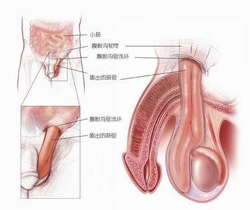 陰疝解剖圖