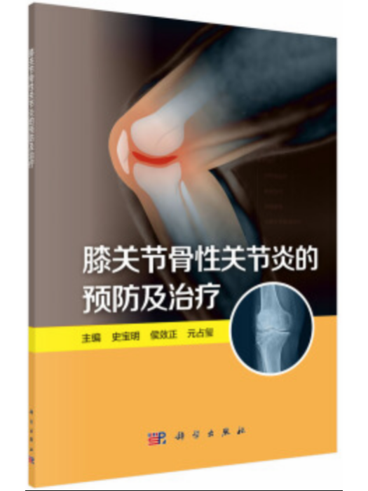 膝關節骨性關節炎的預防及治療