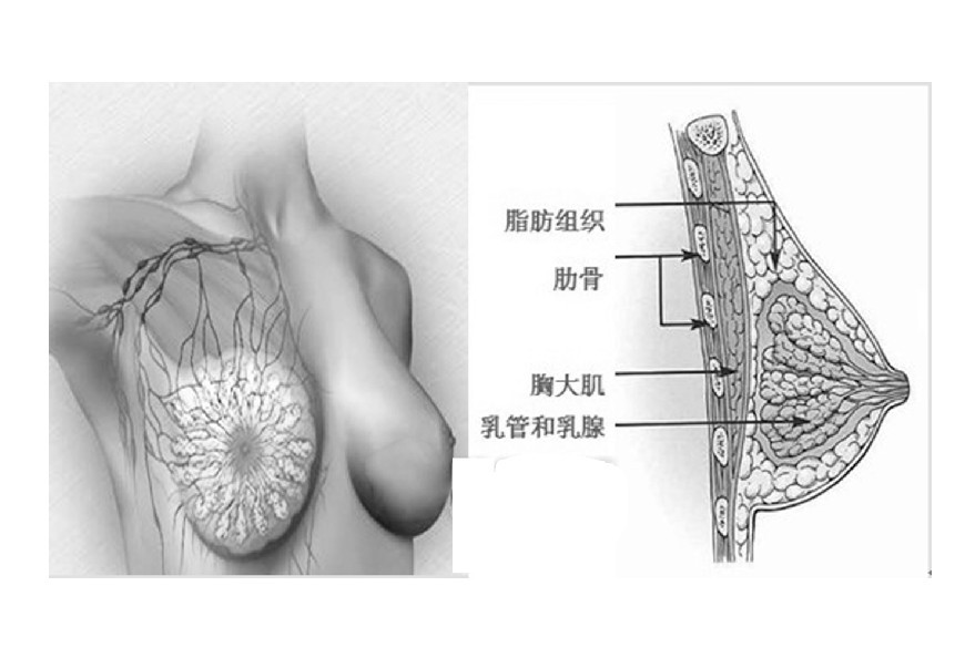 隆胸過程圖