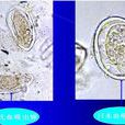 日本分體吸蟲病