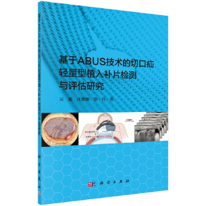 基於ABUS技術的切口疝輕量型植入補片檢測與評估研究