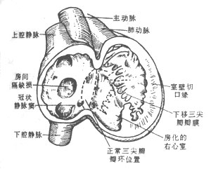 手術治療