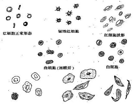 紅細胞(RBC)計數