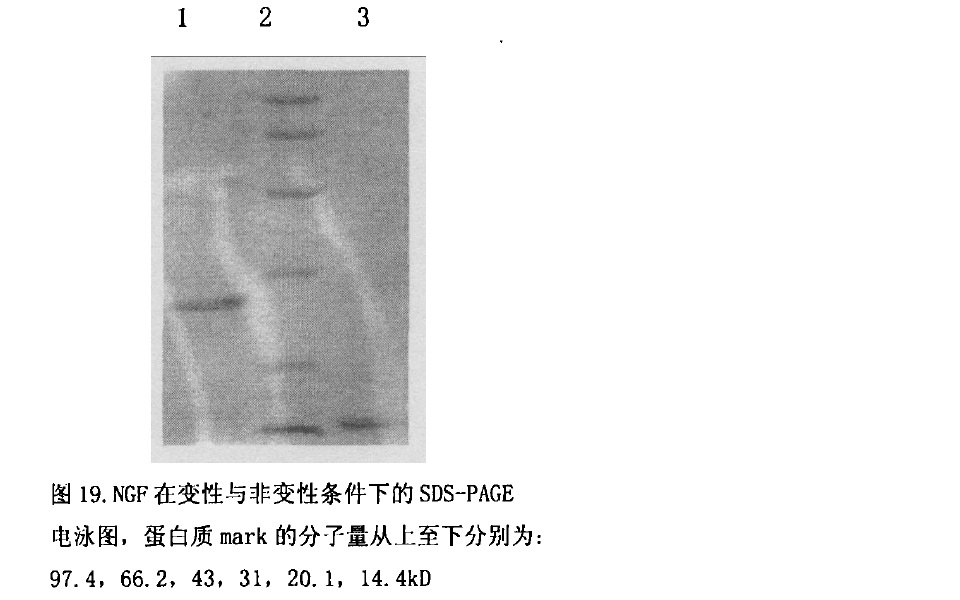 眼鏡蛇毒神經生長因子電泳圖