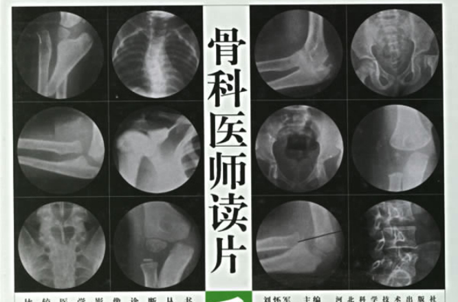 骨科醫師讀片手冊