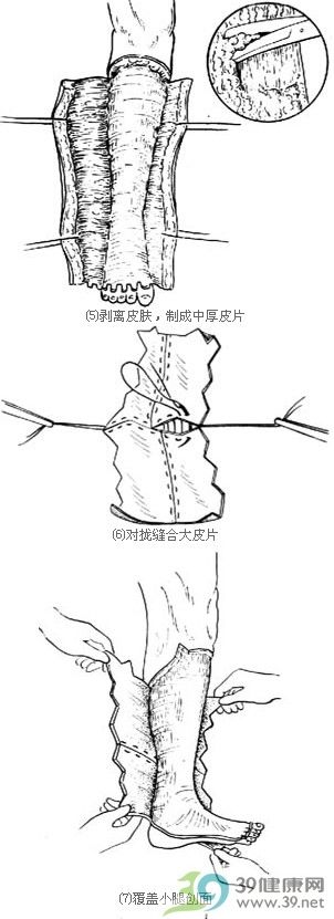 病發症狀