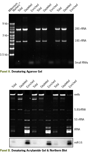 Total RNA