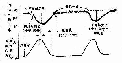 高危妊娠