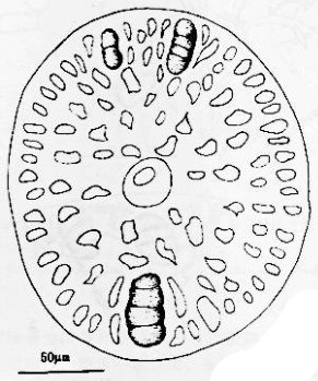 莖刺藻的四分孢子囊枝橫切面