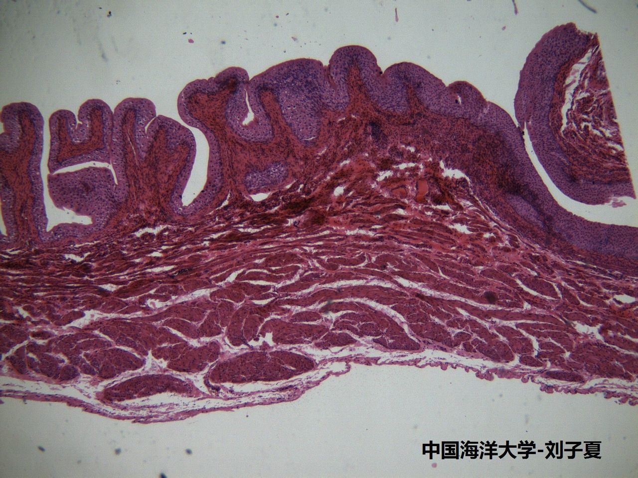 變移上皮