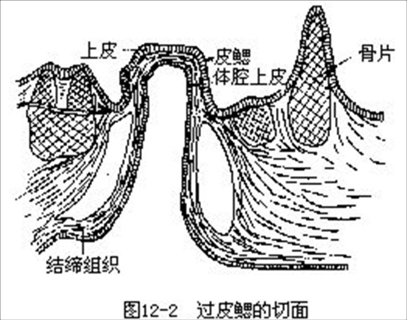 腸盲囊