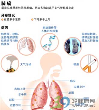 鉻酸鹽製造業工人肺癌