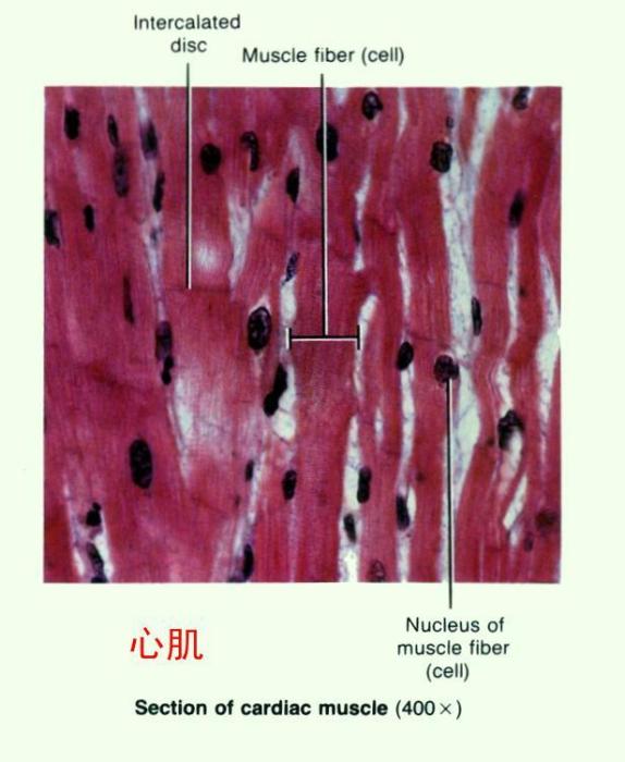 梅毒性心肌樹膠樣腫