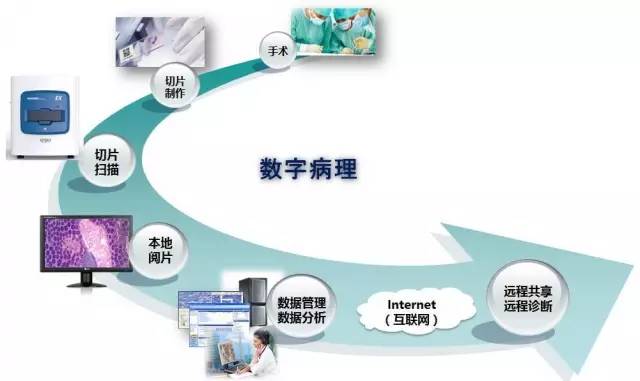 數字病理遠程診斷