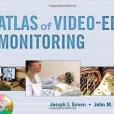 The Atlas of Video-EEG Monitoring