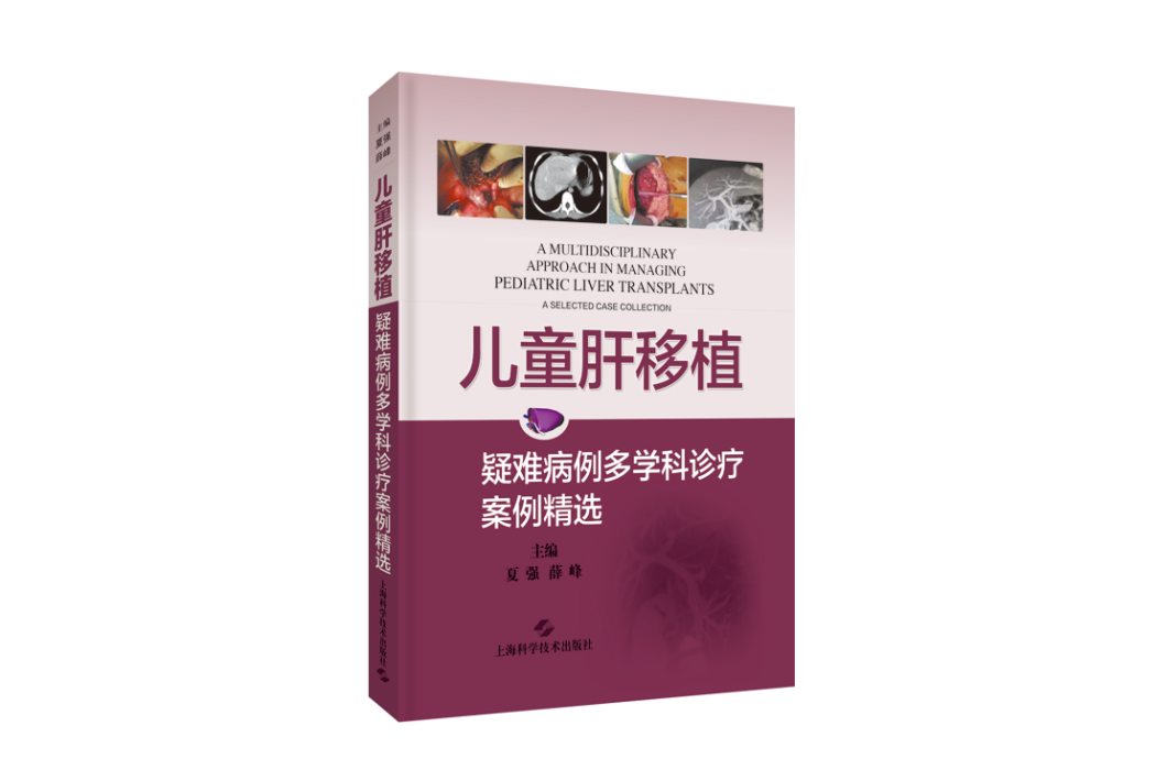 兒童肝移植：疑難病例多學科診療案例精選