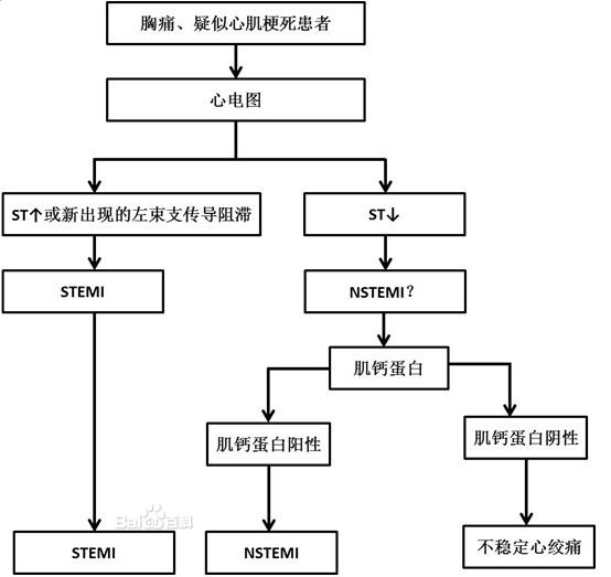 急性冠狀動脈綜合徵