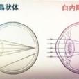 後天性白內障