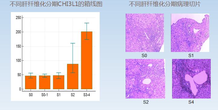 CHI3L1