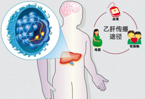 新生兒B肝病毒攜帶者