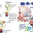 腦血管意外