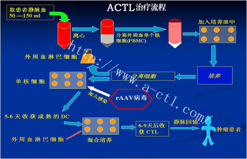 ACTL治療流程