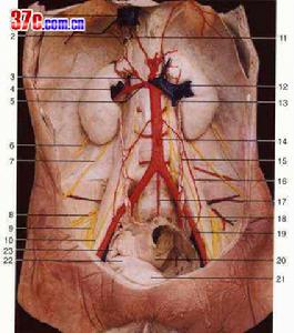 腹膜後感染與膿腫