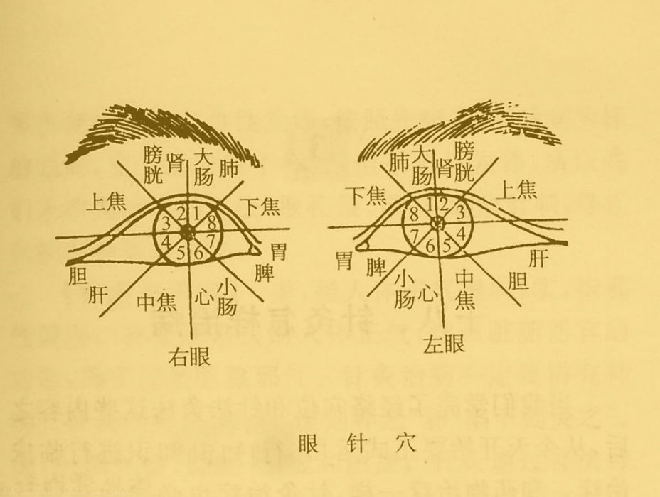 眼針法