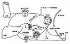 極低密度脂蛋白