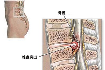 益身輕