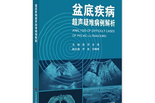 盆底疾病超聲疑難病例解析