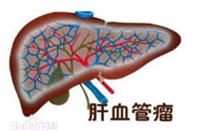 肝血管瘤飲食